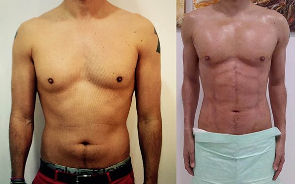 definizione muscoli addominali