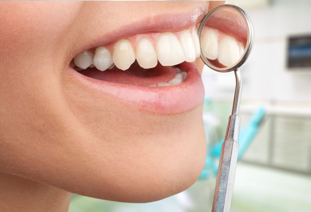 diseno-de-sonrisa.jpg